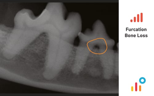 better-teeth4-1