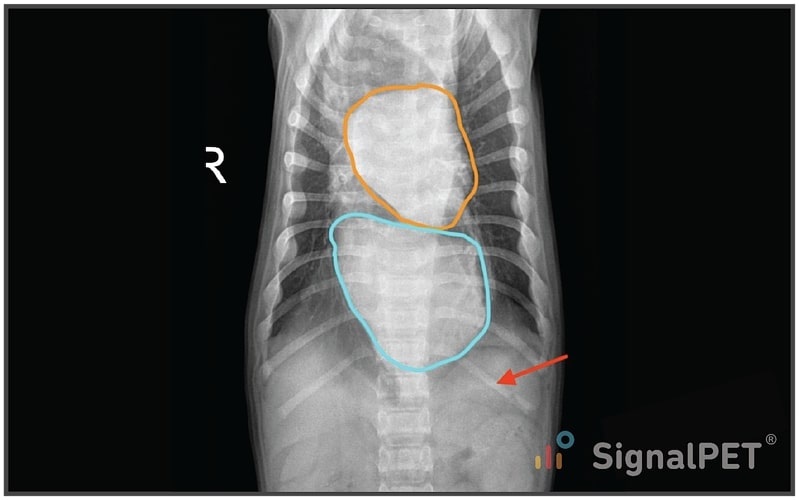 Two heart effect on the VD view of Canine Esophageal Foreign Body