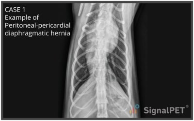 VD view of Peritoneal Pericardial Diaphragmatic Hernias