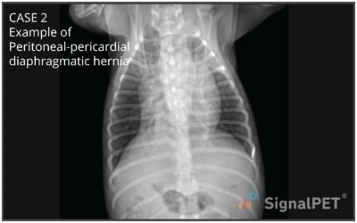VD view of Peritoneal Pericardial Diaphragmatic Hernias