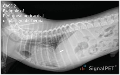 Lateral view of Peritoneal Pericardial Diaphragmatic Hernias