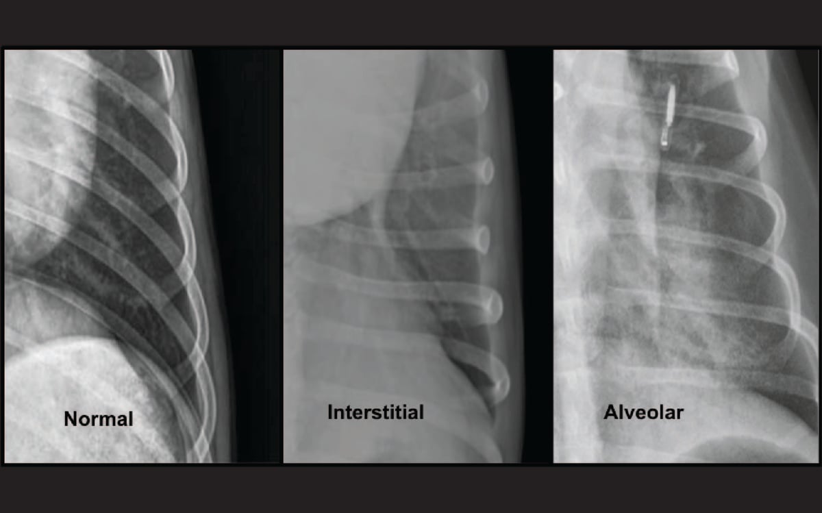 Imaging the Coughing Dog