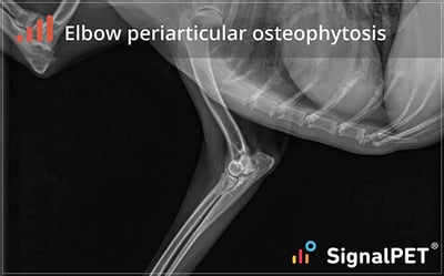 Example of elbow periarticular osteophytosis
