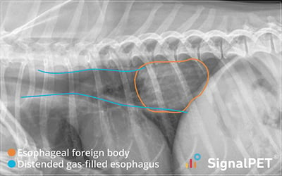Example of an esophageal foreign body and distended gas-filled esophagus