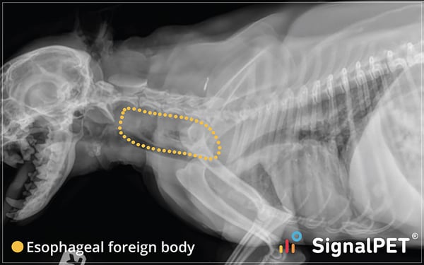 Festive Follies - Tis the season for esophageal foreign bodies!