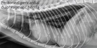 Radiology Case of the Week | Peritoneal Pericardial Diaphragmatic Hernias