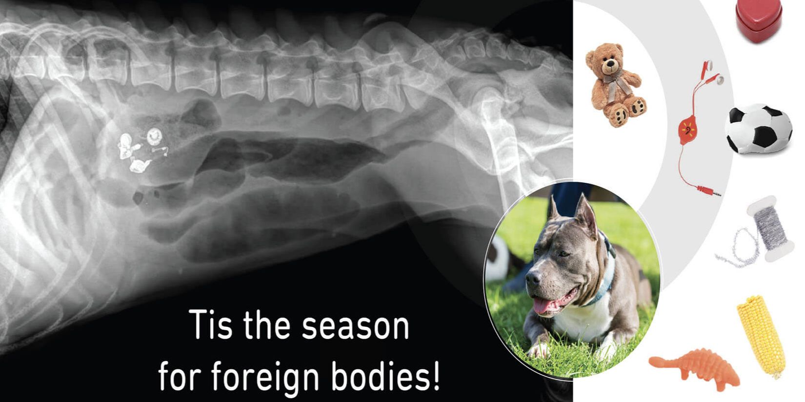 Festive Follies - Tis the season for esophageal foreign bodies!