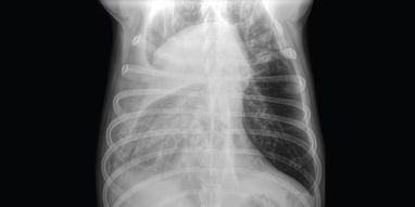 Radiology Case of the Week | Canine Pleural Effusion